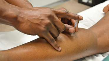 Acupuncture