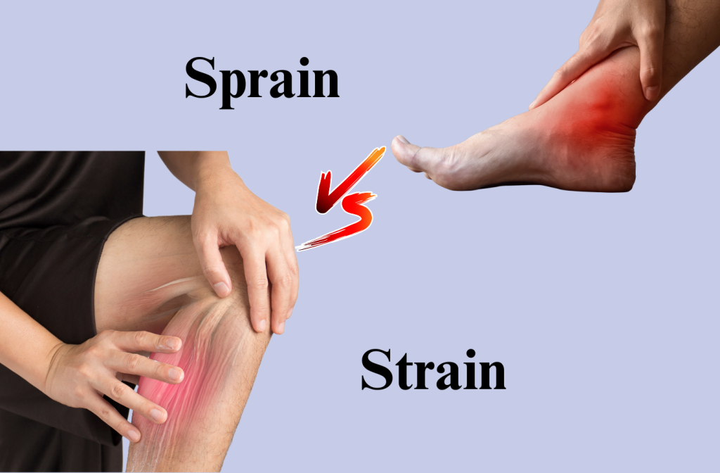 Sprain versus Strain: Are They The Same