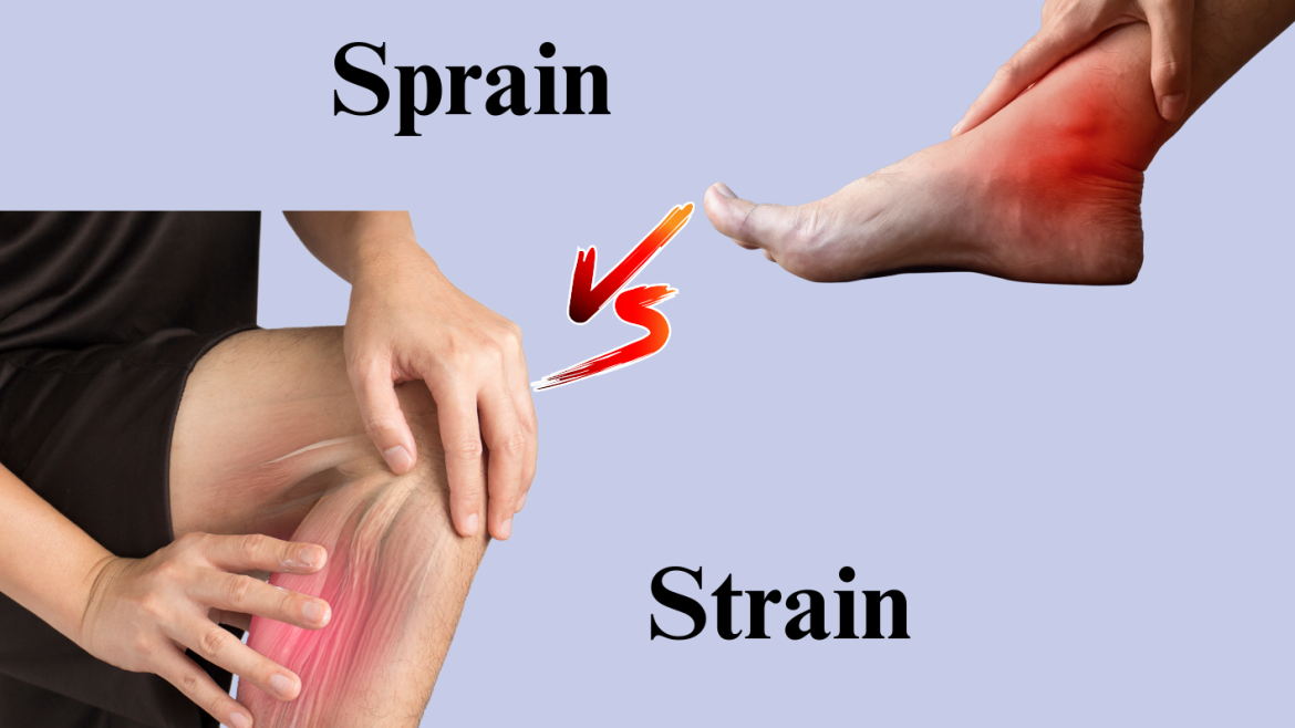 Sprain versus Strain: Are They The Same